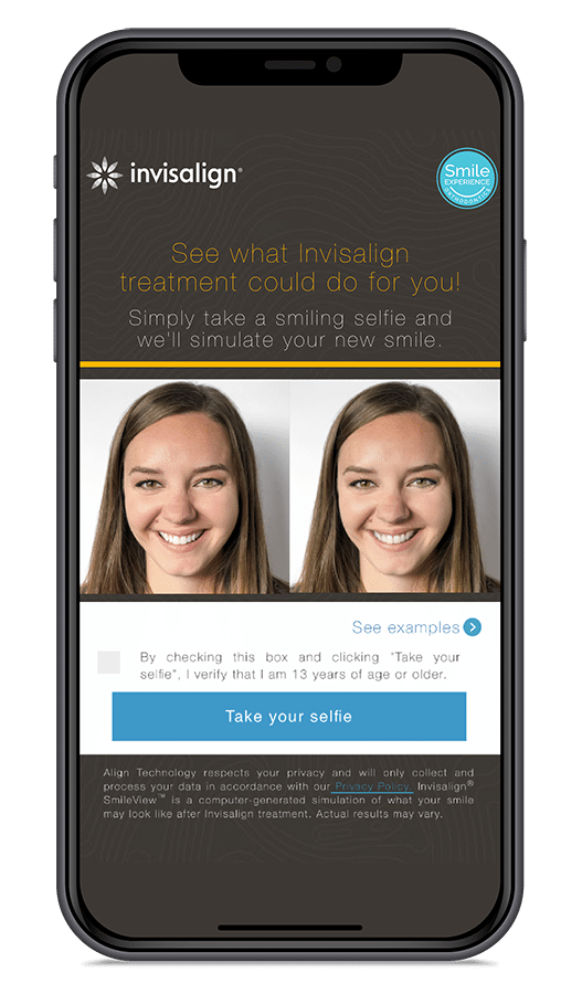 Smile experience invisalign-smileview Invisalign phone smileview