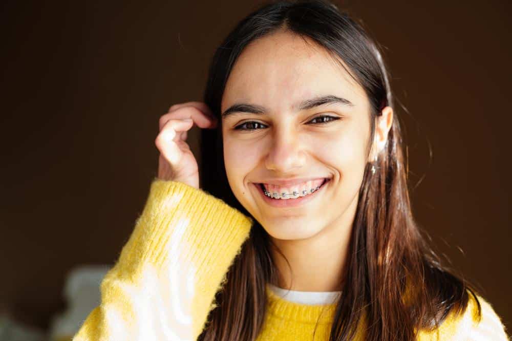 Teenager-smiling-metal-braces Orthodontic patient smiling with braces on teeth